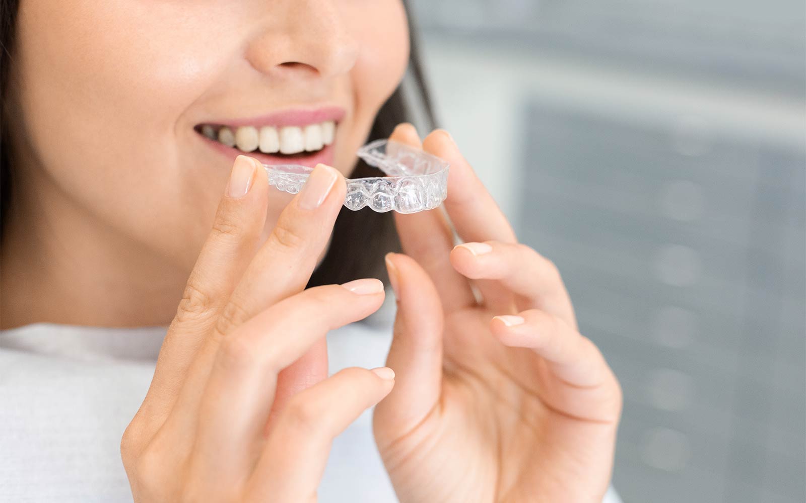 Invisalign: l'apparecchio invisibile - Studio Dentistico Dott. Zamprogno